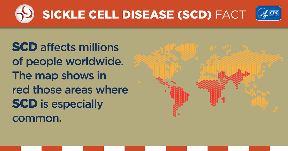 sickle-cell-worldwide-rect