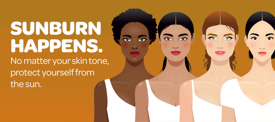 Sunburn happens graphic with four women with different skin tones